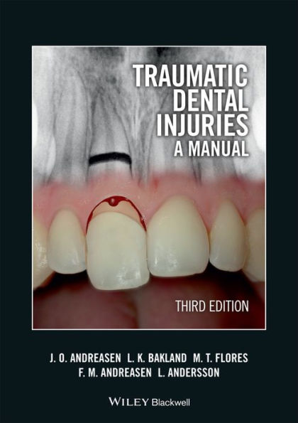 Traumatic Dental Injuries: A Manual