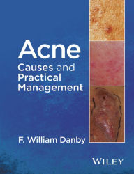 Title: Acne: Causes and Practical Management, Author: F. William Danby