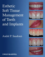 Title: Esthetic Soft Tissue Management of Teeth and Implants, Author: Andre P. Saadoun