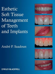 Title: Esthetic Soft Tissue Management of Teeth and Implants / Edition 1, Author: Andre P. Saadoun