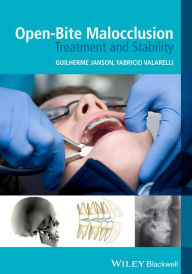 Title: Open-Bite Malocclusion: Treatment and Stability / Edition 1, Author: Guilherme Janson