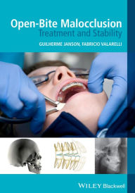 Title: Open-Bite Malocclusion: Treatment and Stability, Author: Guilherme Janson