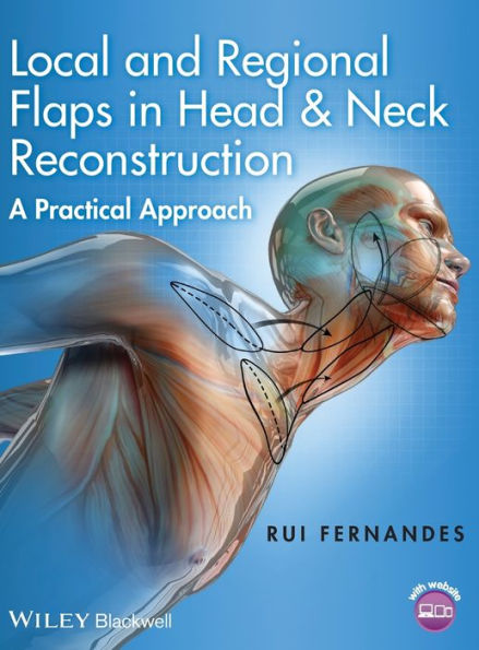Local and Regional Flaps in Head and Neck Reconstruction: A Practical Approach / Edition 1
