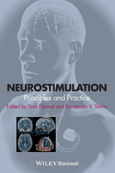 Neurostimulation: Principles and Practice / Edition 1