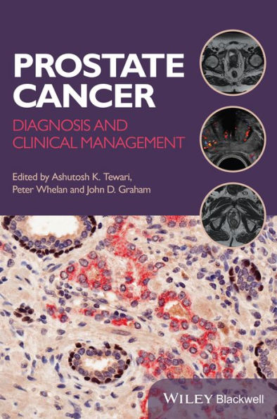 Prostate Cancer: Diagnosis and Clinical Management / Edition 1