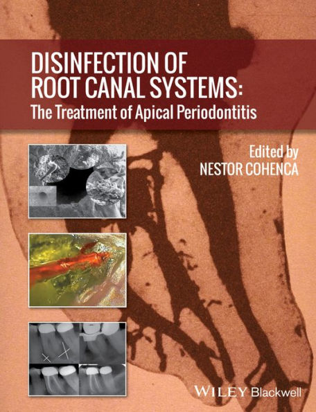 Disinfection of Root Canal Systems: The Treatment of Apical Periodontitis / Edition 1