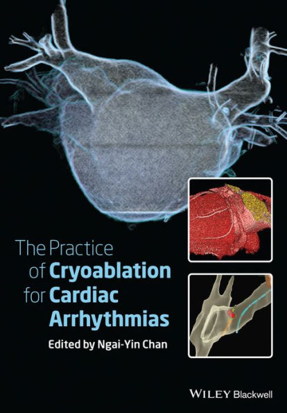 The Practice of Catheter Cryoablation for Cardiac Arrhythmias / Edition 1