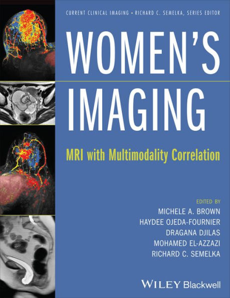 Women's Imaging: MRI with Multimodality Correlation / Edition 1