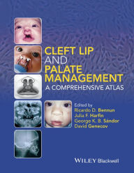 Free e book downloads Cleft Lip and Palate Management: A Comprehensive Atlas 9781118607541