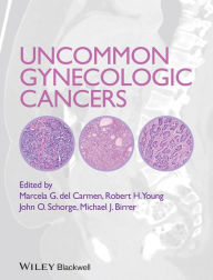 Title: Uncommon Gynecologic Cancers / Edition 1, Author: Marcela del Carmen