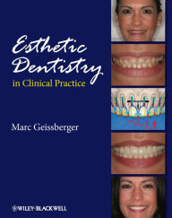 Title: Esthetic Dentistry in Clinical Practice, Author: Marc Geissberger