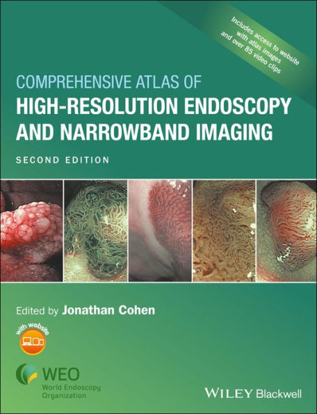 Comprehensive Atlas of High-Resolution Endoscopy and Narrowband Imaging / Edition 2