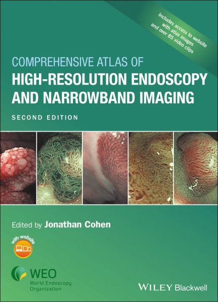 Comprehensive Atlas of High-Resolution Endoscopy and Narrowband Imaging / Edition 2