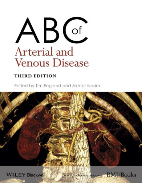 ABC of Arterial and Venous Disease / Edition 3