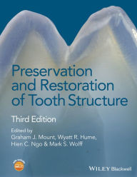 Title: Preservation and Restoration of Tooth Structure, Author: Graham J. Mount