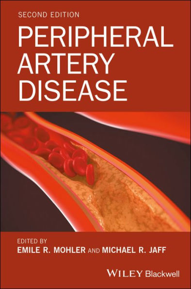 Peripheral Artery Disease / Edition 2