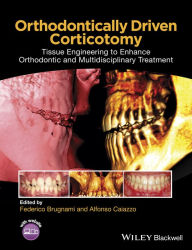 Title: Orthodontically Driven Corticotomy: Tissue Engineering to Enhance Orthodontic and Multidisciplinary Treatment, Author: Federico Brugnami