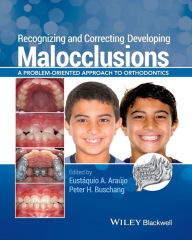 Title: Recognizing and Correcting Developing Malocclusions: A Problem-Oriented Approach to Orthodontics / Edition 1, Author: Eustáquio A. Araújo