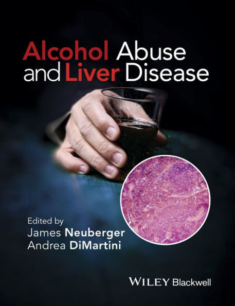 Alcohol Abuse and Liver Disease / Edition 1