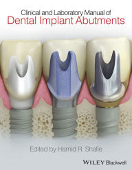 Title: Clinical and Laboratory Manual of Dental Implant Abutments, Author: Hamid R. Shafie