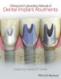 Clinical and Laboratory Manual of Dental Implant Abutments