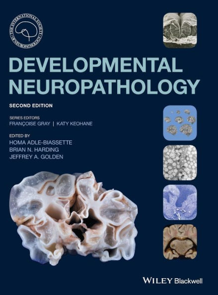 Developmental Neuropathology / Edition 2