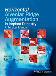 Horizontal Alveolar Ridge Augmentation in Implant Dentistry: A Surgical Manual