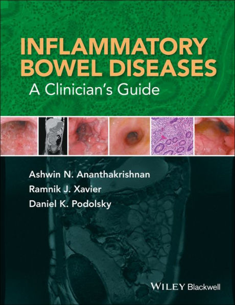 Inflammatory Bowel Diseases: A Clinician's Guide / Edition 1