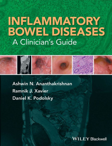 Inflammatory Bowel Diseases: A Clinician's Guide / Edition 1