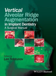 Books for download in pdf format Vertical Augmentation of the Alveolar Ridge in Implant Dentistry (English Edition) ePub RTF FB2