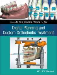 Title: Digital Planning and Custom Orthodontic Treatment, Author: K. Hero Breuning