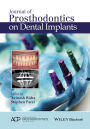 Journal of Prosthodontics on Dental Implants / Edition 1