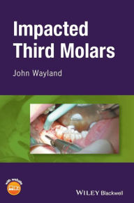 Title: Impacted Third Molars / Edition 1, Author: John Wayland