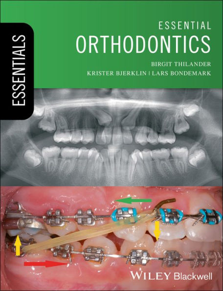 Essential Orthodontics / Edition 1