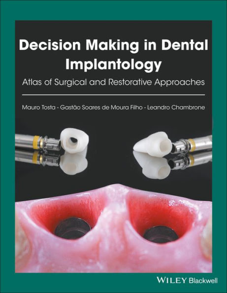 Decision Making in Dental Implantology: Atlas of Surgical and Restorative Approaches / Edition 1