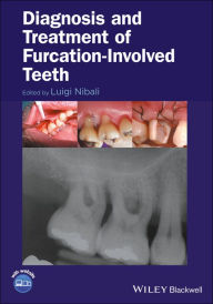 Title: Diagnosis and Treatment of Furcation-Involved Teeth / Edition 1, Author: Luigi Nibali