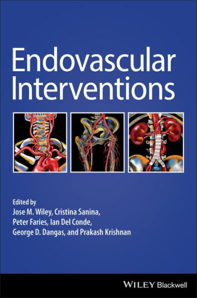 Endovascular Interventions / Edition 1