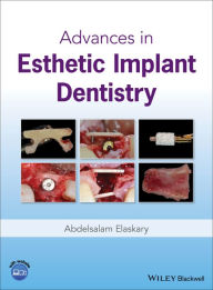 Title: Advances in Esthetic Implant Dentistry / Edition 1, Author: Abdelsalam Elaskary