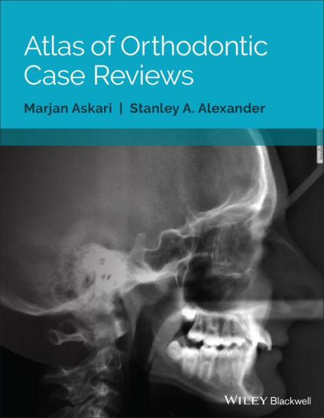 Atlas of Orthodontic Case Reviews / Edition 1