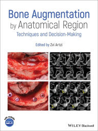 Title: Bone Augmentation by Anatomical Region: Techniques and Decision-Making, Author: Zvi Artzi