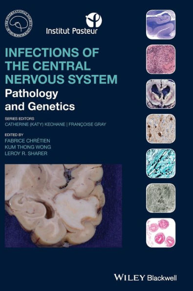 Infections of the Central Nervous System: Pathology and Genetics / Edition 1