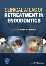 Title: Clinical Atlas of Retreatment in Endodontics, Author: Viresh Chopra