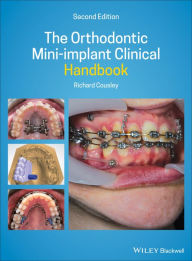 Title: The Orthodontic Mini-implant Clinical Handbook / Edition 2, Author: Richard Cousley