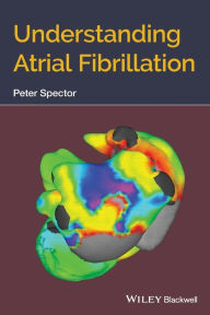 Title: Understanding Atrial Fibrillation / Edition 1, Author: Peter Spector