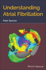 Title: Understanding Atrial Fibrillation, Author: Peter Spector