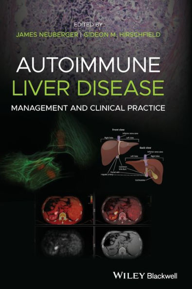 Autoimmune Liver Disease: Management and Clinical Practice / Edition 1