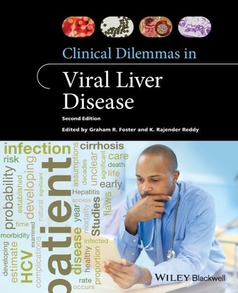 Clinical Dilemmas in Viral Liver Disease / Edition 2