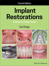 Title: Implant Restorations: A Step-by-Step Guide / Edition 4, Author: Carl Drago