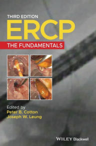 Free mobile epub ebook downloads ERCP: The Fundamentals / Edition 3 by Peter B. Cotton, Joseph W. Leung 9781119601098 (English literature)