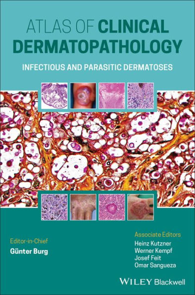 Atlas of Clinical Dermatopathology: Infectious and Parasitic Dermatoses